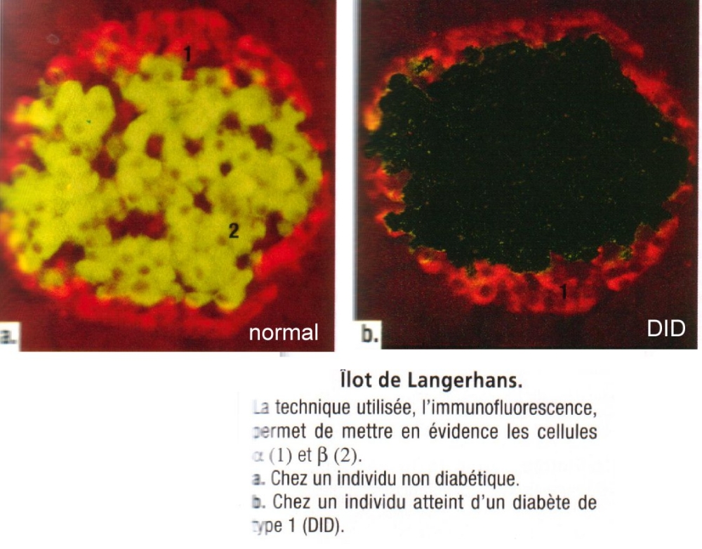 ilots Langerhans.jpg